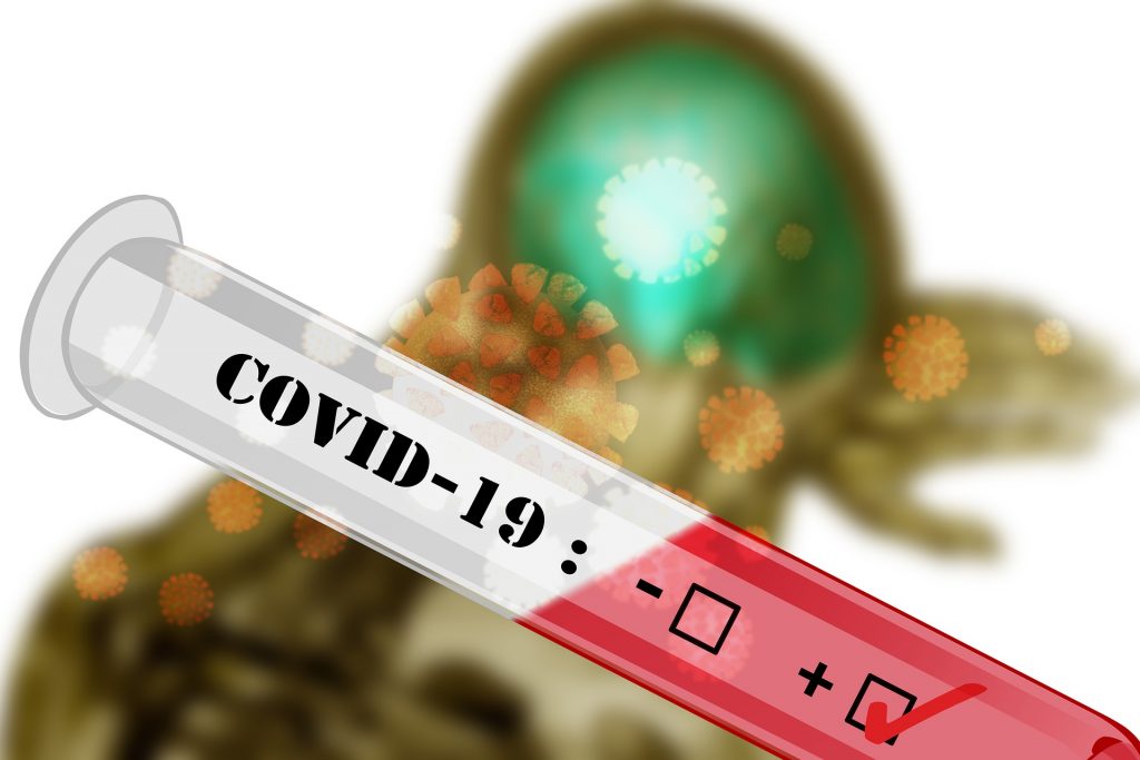 Na obrázku je skúmavka s označením COVID-19 a políčka mínus a s označeným políčkom plus, čiže ide o pozitívny test